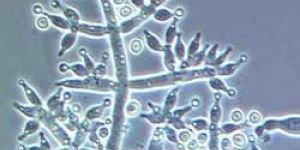 Trichoderma Harzianum Bio Pesticides