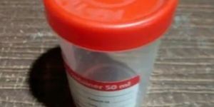 Plastic Urine Container