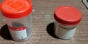 Sterile Urine Container