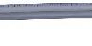 Interlocking Femoral Nail