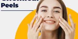 Chemical Peel Treatment