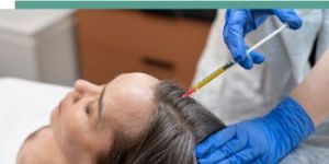 PRP Treatment Service