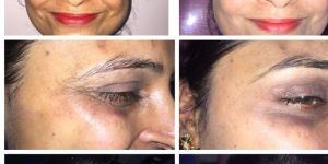 Anti Aging Treatment Services