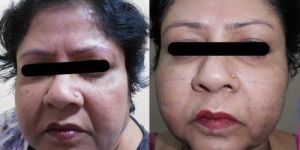 Anti-aging solutions