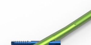 PFAN Interlocking Nail