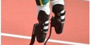 Prosthetic Legs