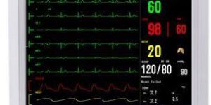 Patient Monitor