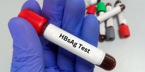 Hepa Scan Hbsag Test Kit