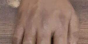 SILICONE FINGER PROSTHESIS