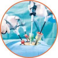 Laparoscopic Surgery