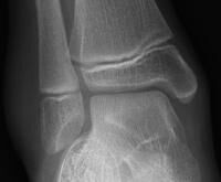 x-ray film