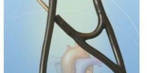 Cardiology Stethoscope