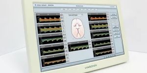 TCD System