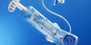 Radial Compression Device