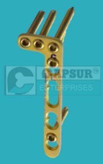 Dorsal Distal Radius L-Plate