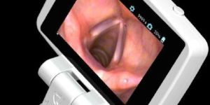 vLarynx - Video Laryngoscope