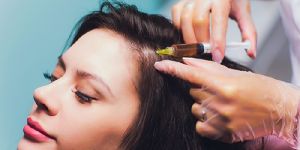 PRP Hair Treatment in Chennai