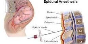 Painless Delivery Treatment Services