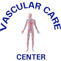 Varicose Veins Treatment