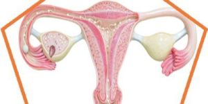 Ovarian Cysts Treatment