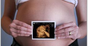 Congenital Anomalies in 3d/4d Scan