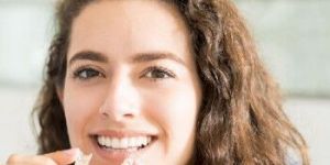 Clear Aligners Services