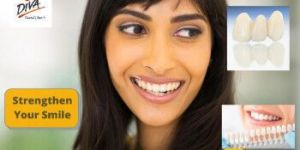 Dental Crown Treatment Services