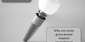 Dental Implants