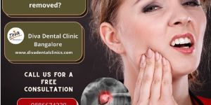 Wisdom Tooth Extraction