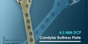 Condylar Buttress Plate