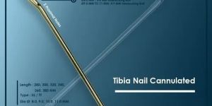 Tibial Interlocking Nail