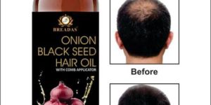 Onion Hair Oil