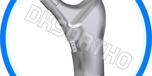 Total Femur Trochanteric Component