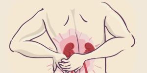 Kidney Stone Ayurvedic Treatment