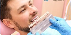 Teeth Whitening Services