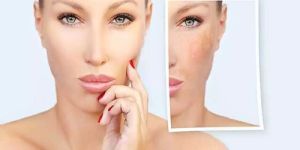 Anti Pigmentation Face Wash