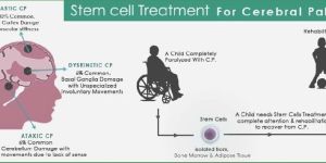 Stem Cell Treatment for Cerebral Palsy