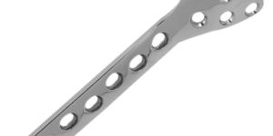 Condylar Buttress Locking Plate