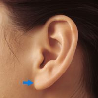 Ear Lobe