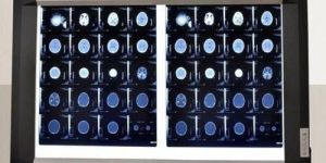 LED Double Film X-Ray View Box