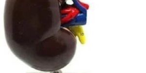 Human Kidney Model