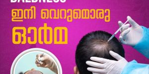 Baldness Treatment