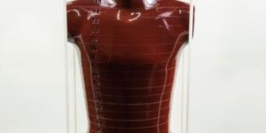 the Alderson Radiation Therapy Phantom