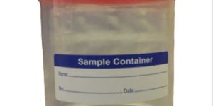 100ml Urine Containers