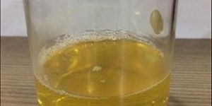 Alpha Olefin Sulfonate