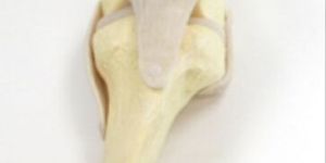 Emmanson Shoes Insole