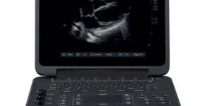 Point of Care Ultrasound Machine