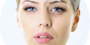 Anti Aging Treatments