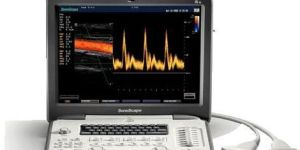 Sonoscape S6 Colour Doppler Ultrasound