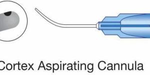 Cortex Aspiration Cannula